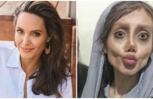 एंजोलीना जोली की तरह दिखने लिए इस लड़की ने कराये 50 सर्जरी , जो नतीजा हुआ आपको चौका देगा Plastic surgery gone wrong in wish to become anjolina jolly